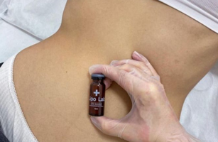 Fat Lipolysis in Bangalore